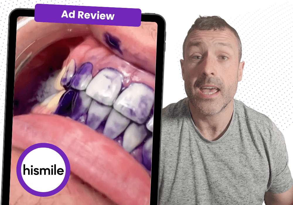 Hismile Ad Review: Why this TikTok ad is rooted in bad practices
